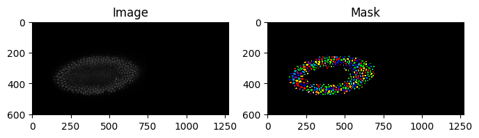 Nuclei Instance Segmentation with UNet